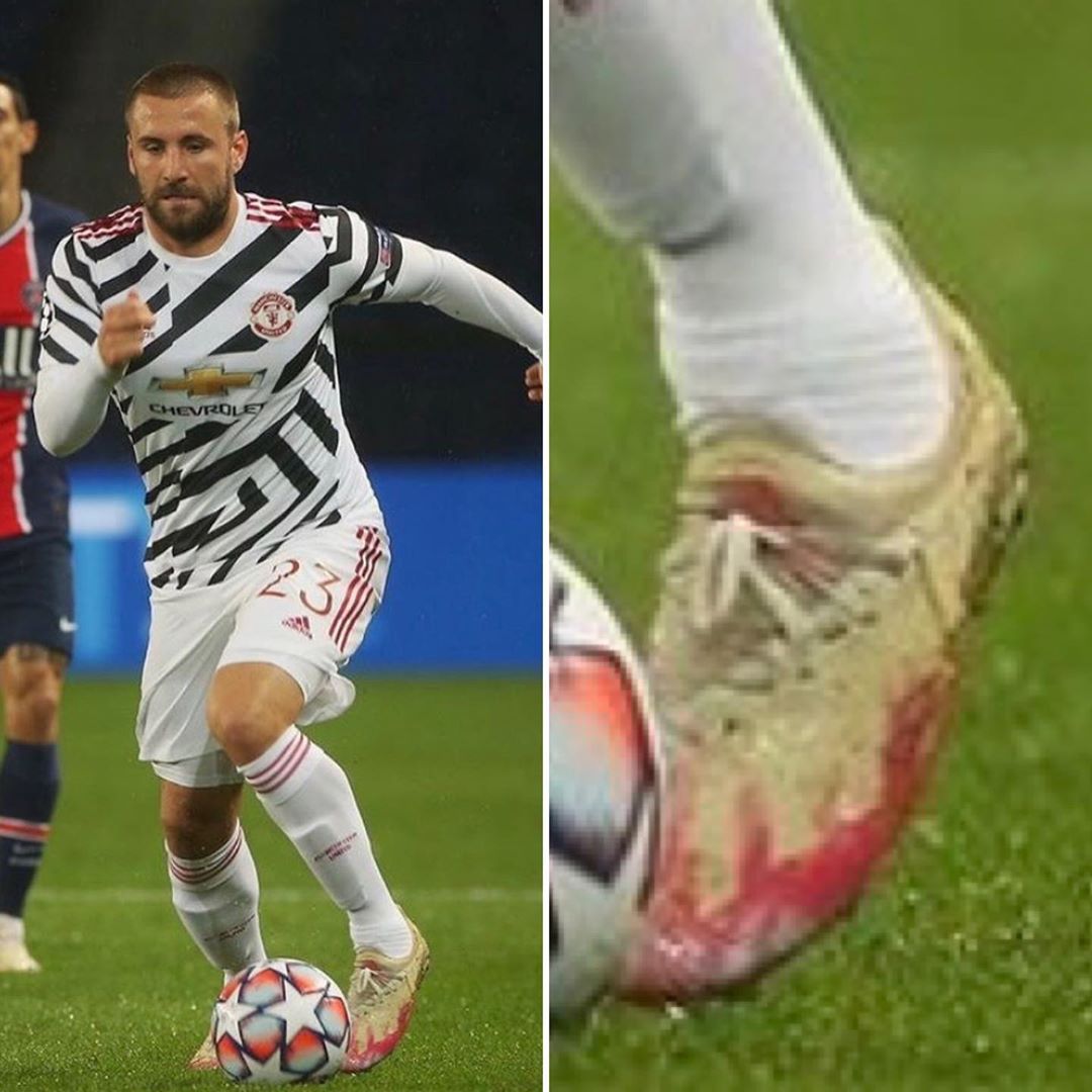 Luke Shaw Wears Defect Adidas Boots Out of Contract Footy